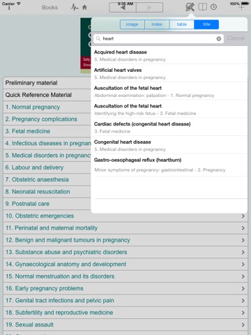 Oxford Handbook of Obstetrics and Gynaecology, Second Edition screenshot 9