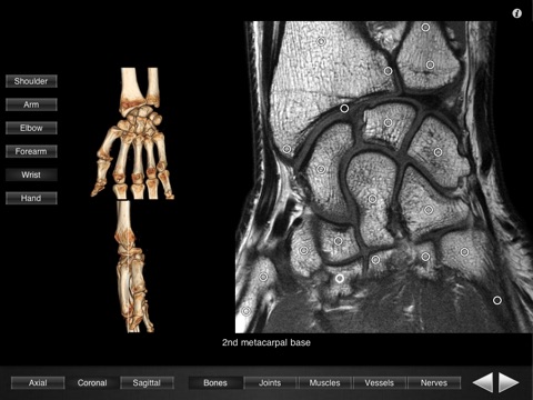 Monster Anatomy - Upper Limbのおすすめ画像3