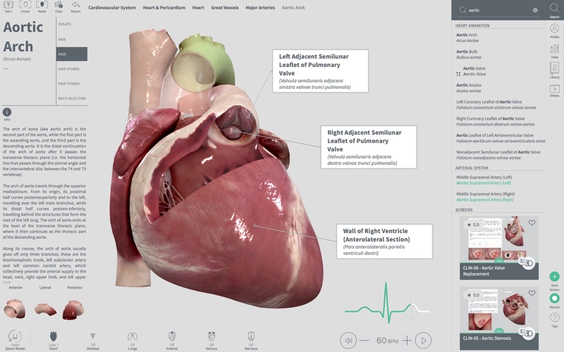 Complete Heart for Mac 1.1 破解版 - 3D心脏医学参考模型