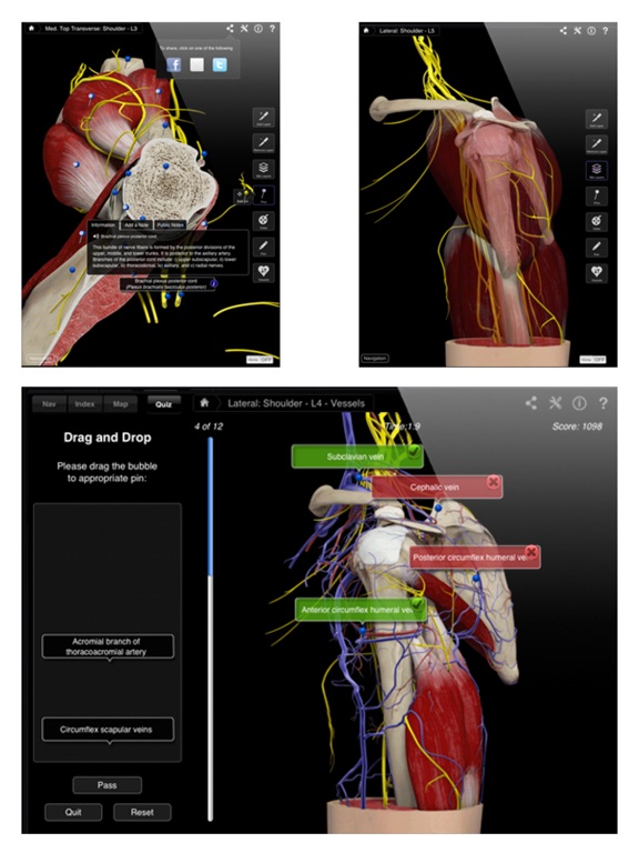 Shoulder Pro III - iPad Screenshots