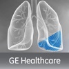 Recruitability for iPhone